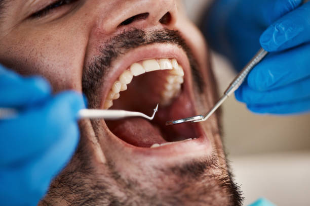 Best Emergency Gum Pain Relief  in Mount Carmel, IL